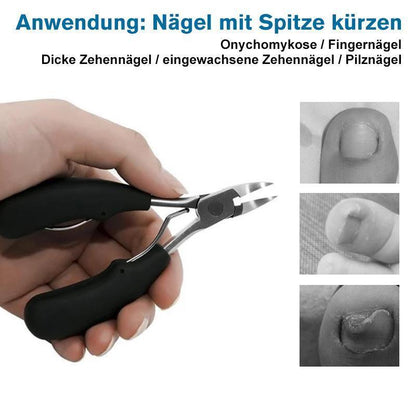 Blaudonau- 304 Edelstahl Nagelknipser-Set, Vorbeugung von Paronychie, Pilzinfektion