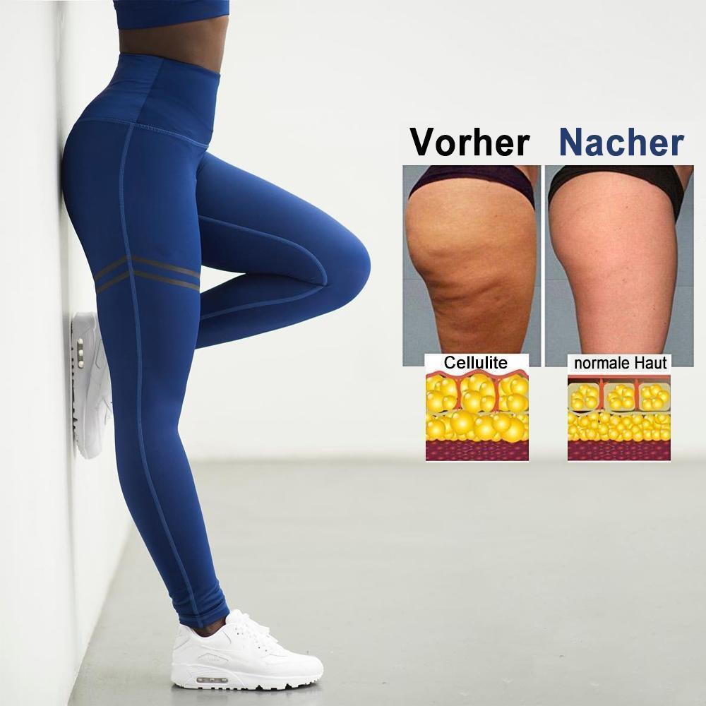 Blaudonau- Damen Anti-Cellulite Kompression Leggings