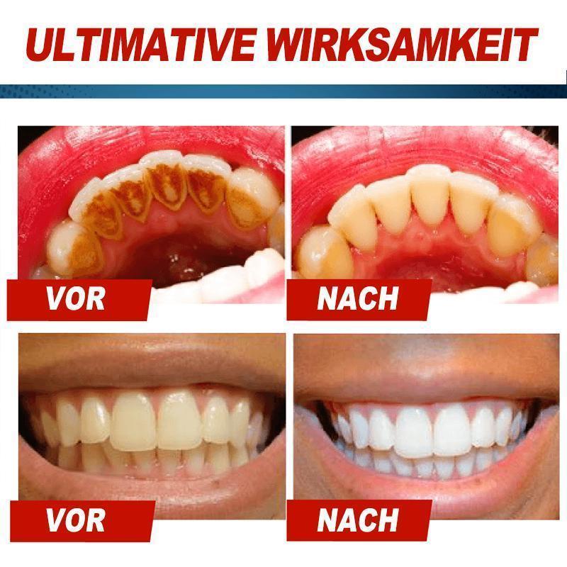 Blaudonau- Intensive Fleckenentfernung Whitening Zahnpasta